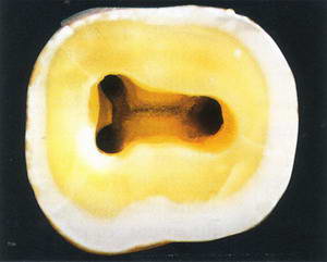 доступ к корневым каналам